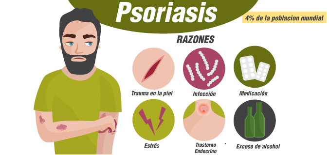 Principales razones que causan psoriasis